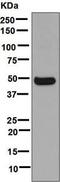 Cytochrome P450 Family 3 Subfamily A Member 4 antibody, ab124921, Abcam, Western Blot image 