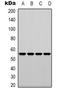 Fascin Actin-Bundling Protein 1 antibody, orb339119, Biorbyt, Western Blot image 