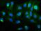 Protein Kinase CGMP-Dependent 1 antibody, A01708-3, Boster Biological Technology, Immunofluorescence image 