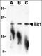 Peptidyl-TRNA Hydrolase 2 antibody, orb87348, Biorbyt, Western Blot image 