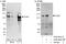 Praja Ring Finger Ubiquitin Ligase 2 antibody, A302-992A, Bethyl Labs, Immunoprecipitation image 