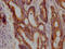 Janus Kinase 1 antibody, CSB-RA227790A0HU, Cusabio, Immunohistochemistry paraffin image 
