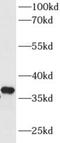 3-oxo-5-beta-steroid 4-dehydrogenase antibody, FNab00265, FineTest, Western Blot image 
