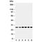 Sonic Hedgehog Signaling Molecule antibody, R30254, NSJ Bioreagents, Western Blot image 
