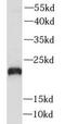 Phospholipase A2 Group XIIA antibody, FNab06502, FineTest, Western Blot image 