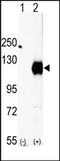 EPH Receptor A2 antibody, AP14275PU-N, Origene, Western Blot image 