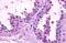 Brain-specific angiogenesis inhibitor 1 antibody, MBS247471, MyBioSource, Immunohistochemistry paraffin image 