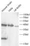 Aldo-Keto Reductase Family 1 Member C1 antibody, FNab10393, FineTest, Western Blot image 