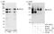 ERCC Excision Repair 6, Chromatin Remodeling Factor antibody, A301-345A, Bethyl Labs, Immunoprecipitation image 