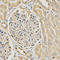 Checkpoint protein HUS1 antibody, LS-C334043, Lifespan Biosciences, Immunohistochemistry frozen image 
