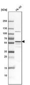 Megakaryocyte-Associated Tyrosine Kinase antibody, NBP1-84487, Novus Biologicals, Western Blot image 