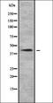 NADH:Ubiquinone Oxidoreductase Subunit A10 antibody, orb335046, Biorbyt, Western Blot image 