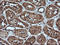 Melan-A antibody, LS-C174642, Lifespan Biosciences, Immunohistochemistry frozen image 