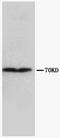 Collagen Type III Alpha 1 Chain antibody, AM20612PU-N, Origene, Western Blot image 
