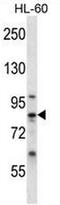Calpain 6 antibody, AP50726PU-N, Origene, Western Blot image 