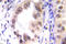 Signal Transducer And Activator Of Transcription 1 antibody, LS-C178103, Lifespan Biosciences, Immunohistochemistry paraffin image 