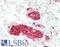 Serine/threonine-protein kinase LMTK3 antibody, LS-B9975, Lifespan Biosciences, Immunohistochemistry paraffin image 