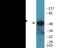 C-Terminal Src Kinase antibody, EKC2023, Boster Biological Technology, Western Blot image 