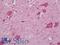 67 kDa laminin receptor antibody, LS-B12557, Lifespan Biosciences, Immunohistochemistry paraffin image 