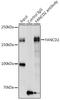 FA Complementation Group D2 antibody, GTX55614, GeneTex, Immunoprecipitation image 