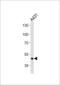 Fibrinogen Gamma Chain antibody, LS-C166145, Lifespan Biosciences, Western Blot image 