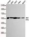 Protein Phosphatase 5 Catalytic Subunit antibody, GTX49269, GeneTex, Western Blot image 