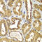 RAB1B, Member RAS Oncogene Family antibody, LS-C349208, Lifespan Biosciences, Immunohistochemistry paraffin image 