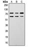 Lamin A/C antibody, LS-C358797, Lifespan Biosciences, Western Blot image 