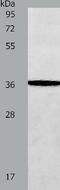 Aminoadipate-Semialdehyde Dehydrogenase-Phosphopantetheinyl Transferase antibody, TA322350, Origene, Western Blot image 