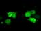 Cilia And Flagella Associated Protein 298 antibody, GTX84746, GeneTex, Immunocytochemistry image 
