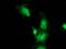 Bestrophin-3 antibody, MA5-25306, Invitrogen Antibodies, Immunocytochemistry image 