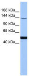 Mitogen-Activated Protein Kinase Kinase Kinase 1 antibody, TA346746, Origene, Western Blot image 