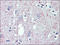Gamma-aminobutyric acid type B receptor subunit 1 antibody, AP23115PU-N, Origene, Immunohistochemistry frozen image 