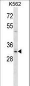 Homeobox B8 antibody, LS-C164408, Lifespan Biosciences, Western Blot image 