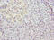 Methyltransferase Like 25 antibody, orb35404, Biorbyt, Immunohistochemistry paraffin image 
