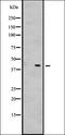 Microtubule Associated Serine/Threonine Kinase 1 antibody, orb337688, Biorbyt, Western Blot image 