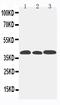 C-C Motif Chemokine Receptor 5 (Gene/Pseudogene) antibody, PA1016-2, Boster Biological Technology, Western Blot image 