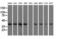 3-Hydroxyisobutyryl-CoA Hydrolase antibody, GTX84362, GeneTex, Western Blot image 