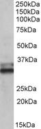Electron transfer flavoprotein subunit alpha, mitochondrial antibody, EB10173, Everest Biotech, Western Blot image 