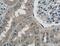 Mitochondrial Ribosomal Protein S5 antibody, 16428-1-AP, Proteintech Group, Immunohistochemistry paraffin image 