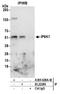 Inositol Hexakisphosphate Kinase 1 antibody, A305-628A-M, Bethyl Labs, Immunoprecipitation image 