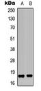 Protein Phosphatase 1 Regulatory Inhibitor Subunit 14C antibody, LS-C368468, Lifespan Biosciences, Western Blot image 