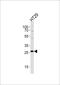 Nicotinamide N-Methyltransferase antibody, PA5-48630, Invitrogen Antibodies, Western Blot image 