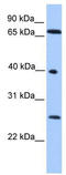 L3MBTL Histone Methyl-Lysine Binding Protein 2 antibody, TA329105, Origene, Western Blot image 