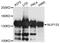 Nuclear pore complex protein Nup133 antibody, A8818, ABclonal Technology, Western Blot image 