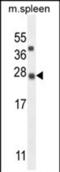 KIAA1143 antibody, PA5-71479, Invitrogen Antibodies, Western Blot image 