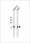 Ubiquitin Conjugating Enzyme E2 C antibody, M01491, Boster Biological Technology, Western Blot image 