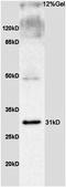 Mitochondrial dicarboxylate carrier antibody, orb6965, Biorbyt, Western Blot image 
