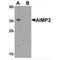 Aminoacyl tRNA synthase complex-interacting multifunctional protein 2 antibody, MBS153415, MyBioSource, Western Blot image 