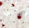Polyubiquitin-B antibody, BML-PW0600-0025, Enzo Life Sciences, Immunohistochemistry frozen image 